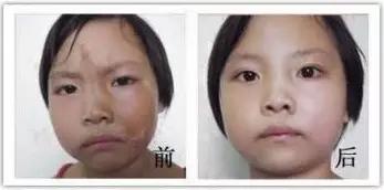算命算到了我的胎记_胎记算命图_算命的说胎记去掉不好