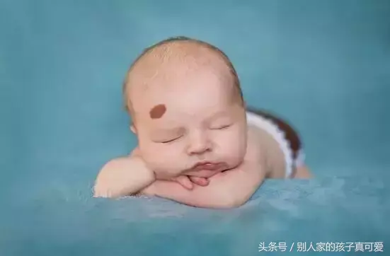 算命算到了我的胎记_算命胎记说明什么_胎记算命图