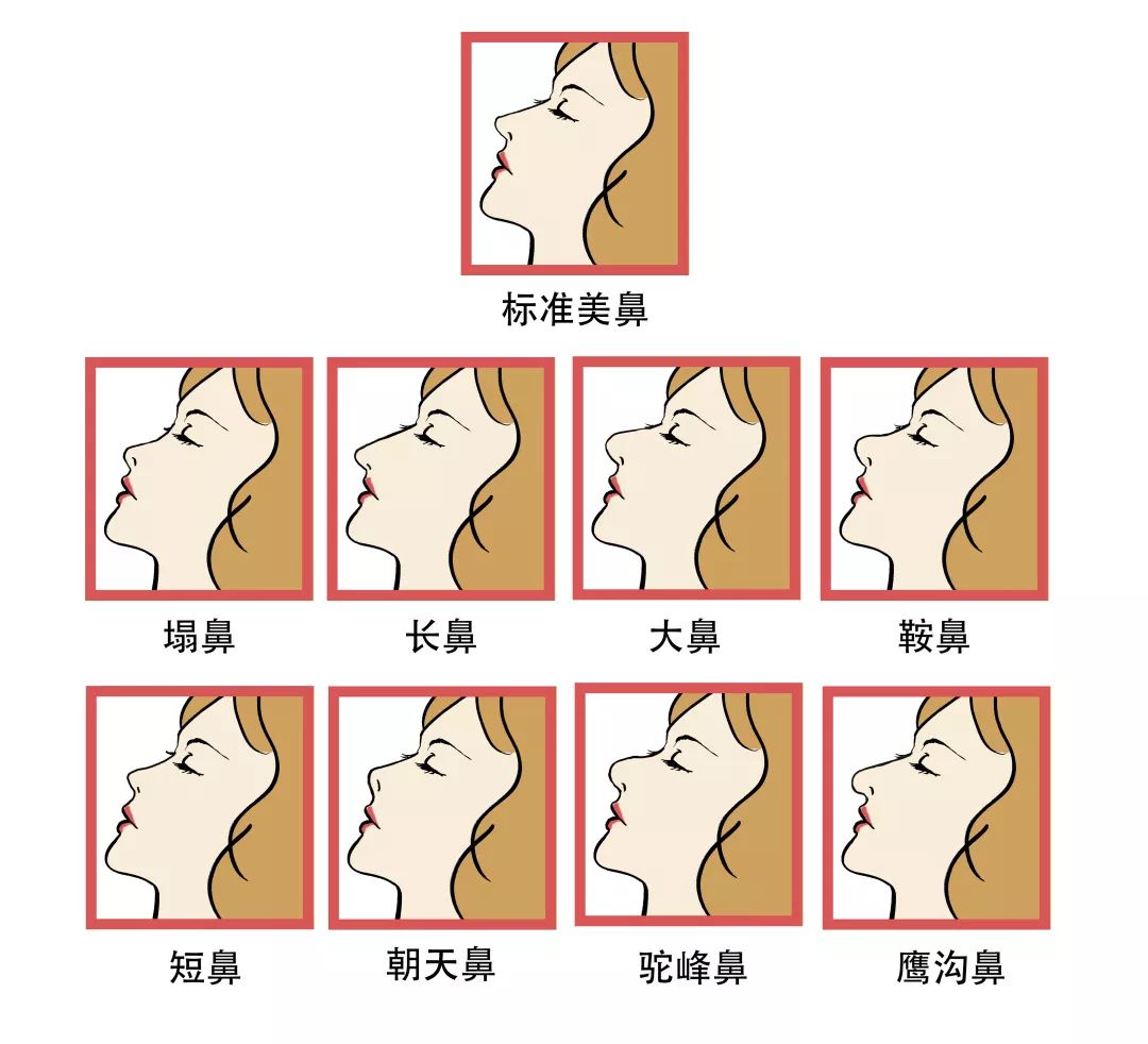 狮鼻面相女_狮鼻男人命运_狮鼻