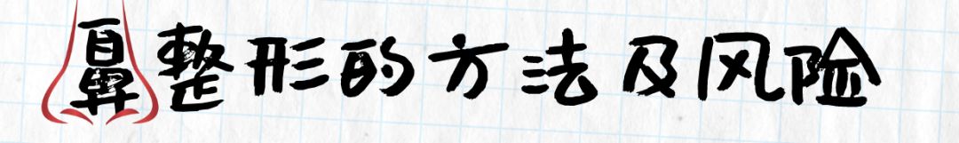 狮鼻面相女_狮鼻男人命运_狮鼻
