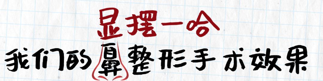 狮鼻面相女_狮鼻_狮鼻男人命运