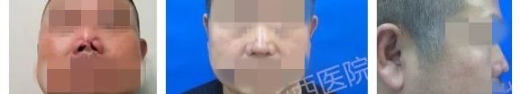 狮鼻男人命运_狮鼻_狮鼻面相女