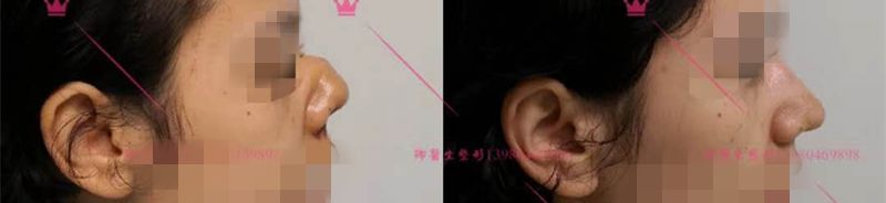 狮鼻_狮鼻面相女_狮鼻男人命运