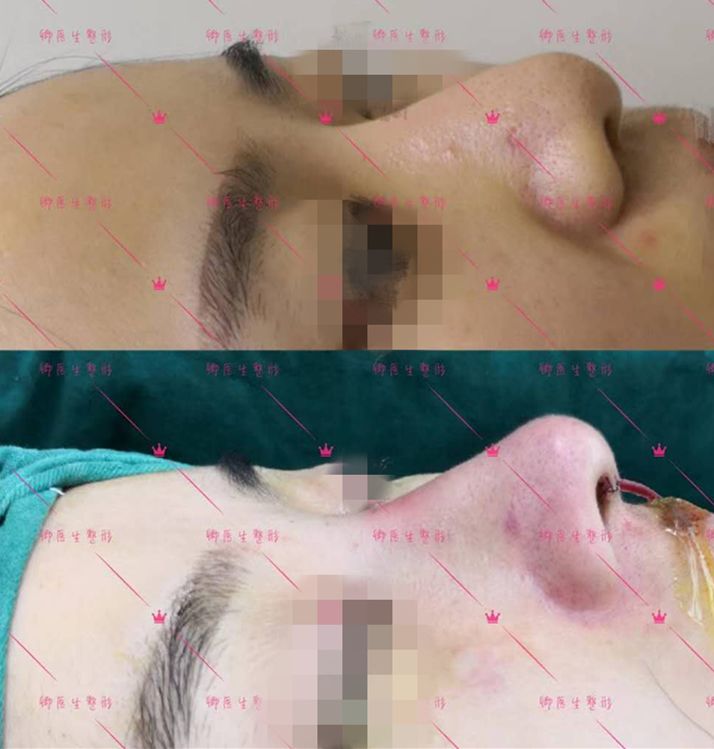 狮鼻_狮鼻男人命运_狮鼻面相女