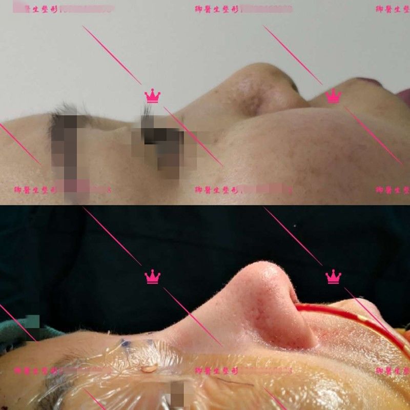 狮鼻男人命运_狮鼻面相女_狮鼻