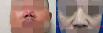 狮鼻男人命运_狮鼻面相女_狮鼻