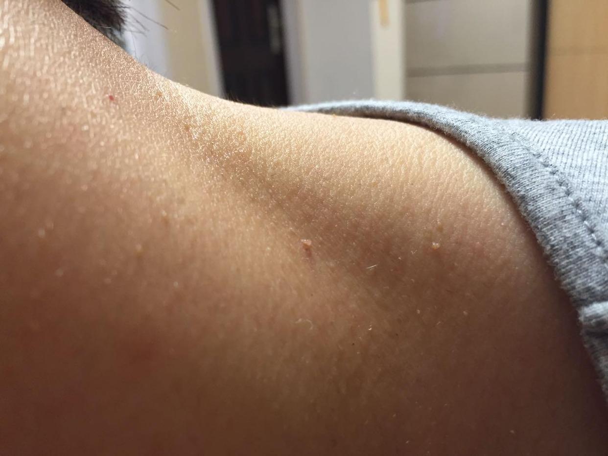 脖子上的皮松弛是什么原因_脖子上有白色的一块怎么回事_脖子上的痣