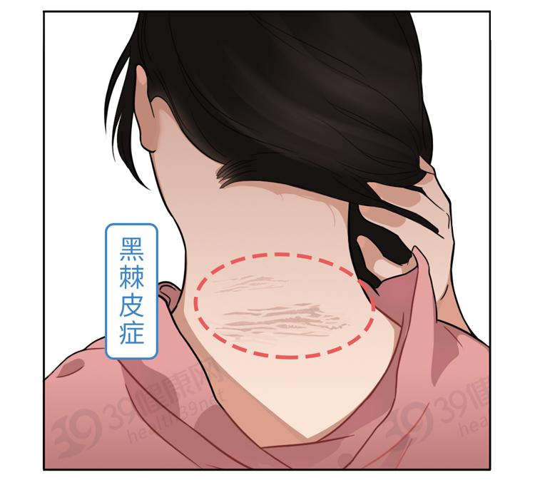 脖子上的痣_脖子上有白色的一块怎么回事_脖子上的皮松弛是什么原因
