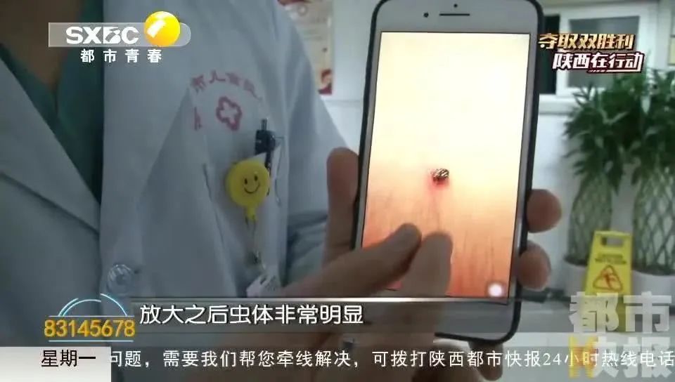 脖子上有白色的一块怎么回事_脖子上的皮松弛是什么原因_脖子上的痣