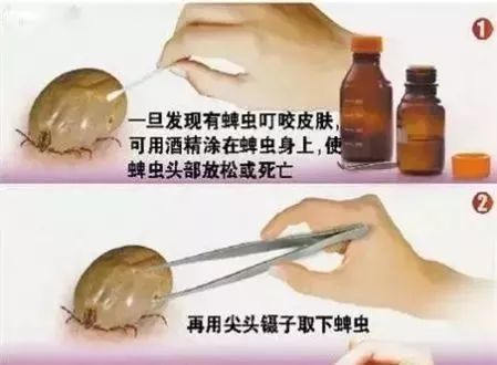 脖子上的痣_脖子上的皮松弛是什么原因_脖子上有白色的一块怎么回事