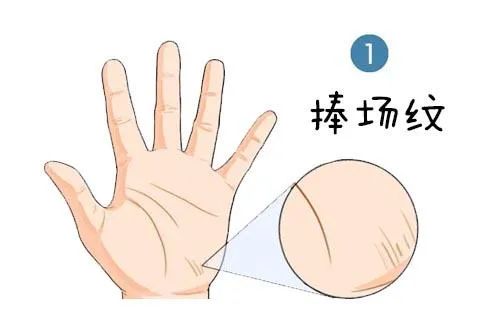 捧场纹在什么位置_捧场纹_捧场纹面相有什么说法