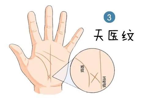 捧场纹_捧场纹在什么位置_捧场纹面相有什么说法
